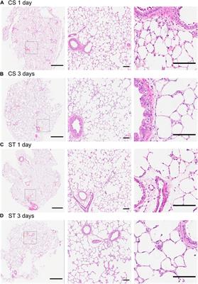 A tunable physiomimetic stretch system evaluated with precision cut lung slices and recellularized human lung scaffolds